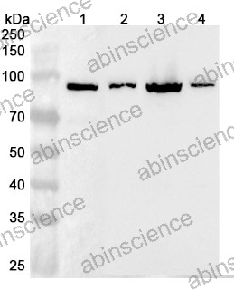 Anti-Human QARS1 Polyclonal Antibody