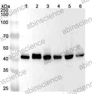 Anti-Human ERP44 Polyclonal Antibody