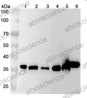 Anti-Human CPOX Polyclonal Antibody