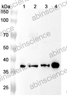Anti-Human FDPS Polyclonal Antibody