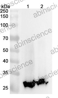 Anti-Human CYB5R1 Polyclonal Antibody