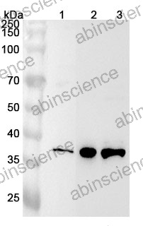 Anti-Human MRM1 Polyclonal Antibody