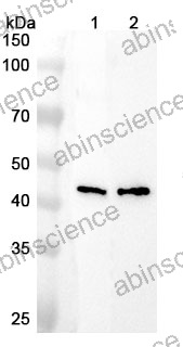 Anti-Human B4GALT2 Polyclonal Antibody