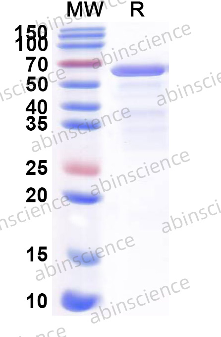Human ATP5F1A Recombinant Protein (N-His)