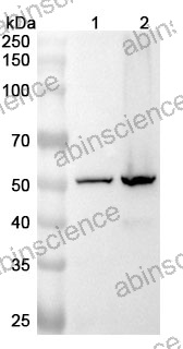 Anti-Human ATP5F1A Polyclonal Antibody