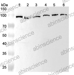 Anti-Human KPNB1 Polyclonal Antibody