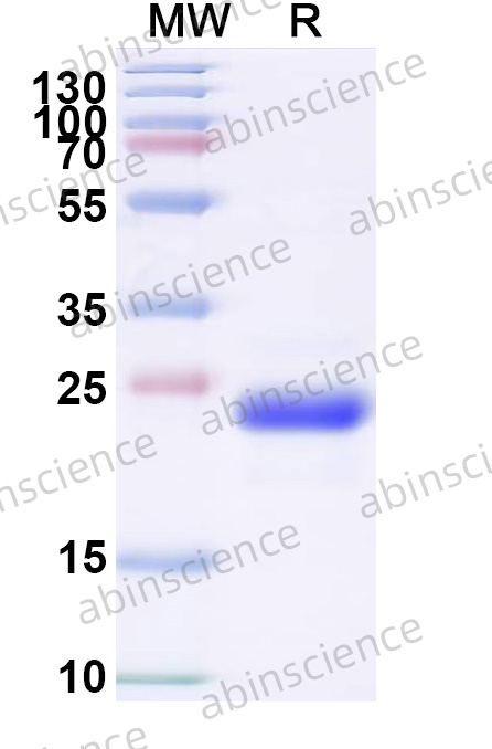 Human PLAC8 Recombinant Protein (N-His-SUMO)