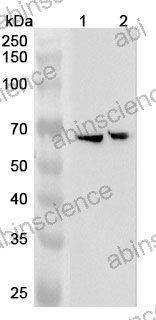 Anti-Human CRAT Polyclonal Antibody