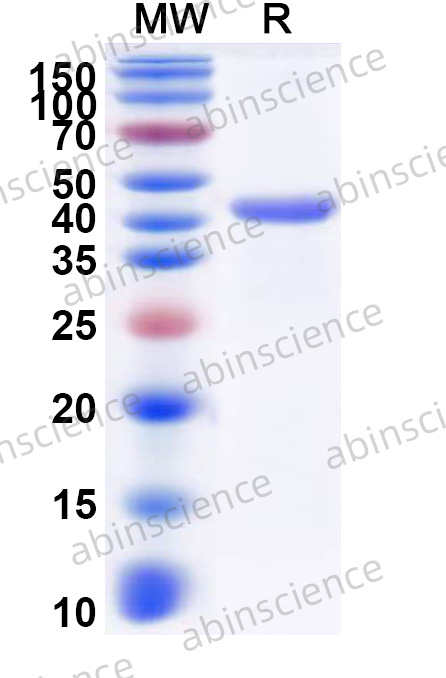 Human FBXL17 Recombinant Protein (N-His)