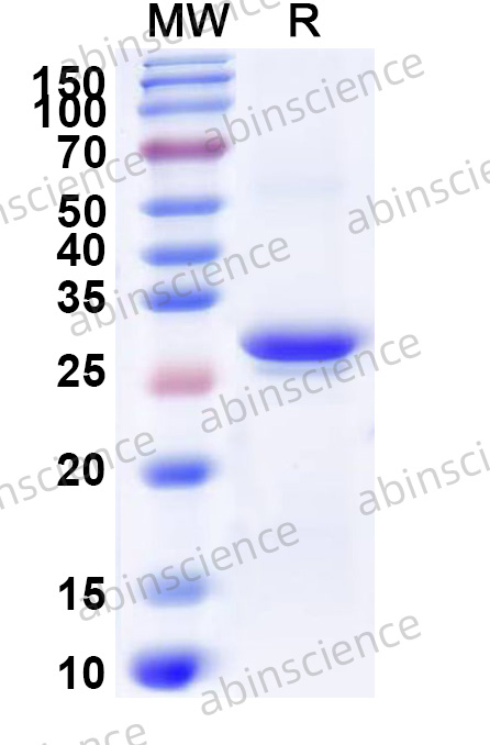Human ATP4B Recombinant Protein (N-His)