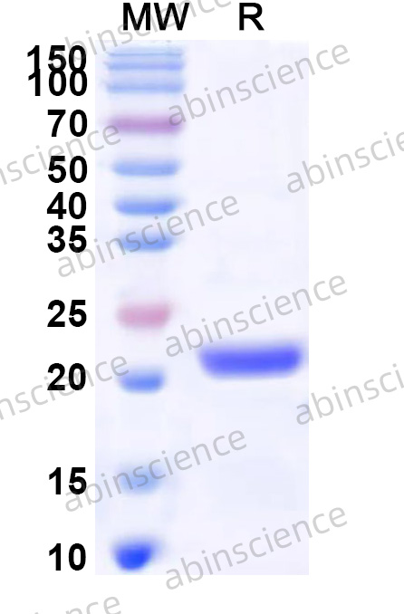 Human SLC25A11 Recombinant Protein (N-His-KSI)