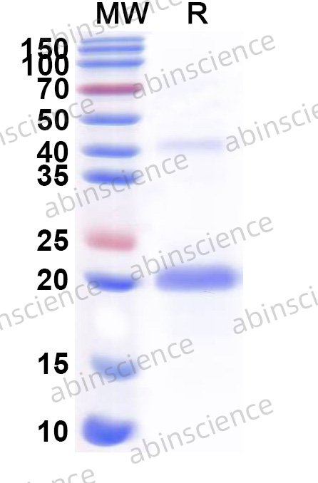 Human SNAI2 Recombinant Protein (N-His)