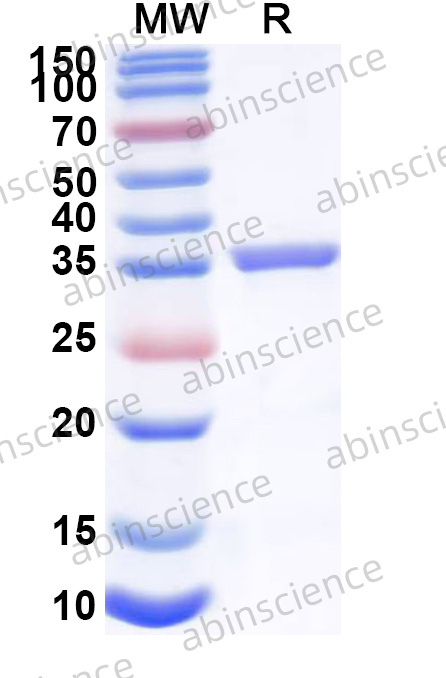 Human ASAP3 Recombinant Protein (N-His)