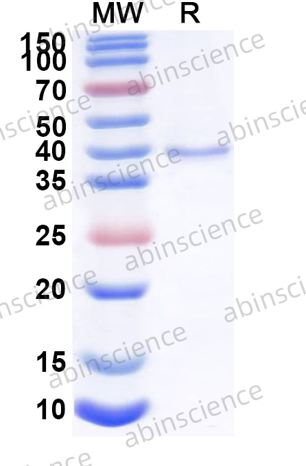 Human EPG5 Recombinant Protein (N-His)