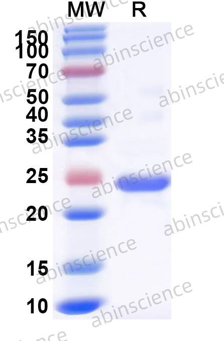 Human CCDC15 Recombinant Protein (N-His)