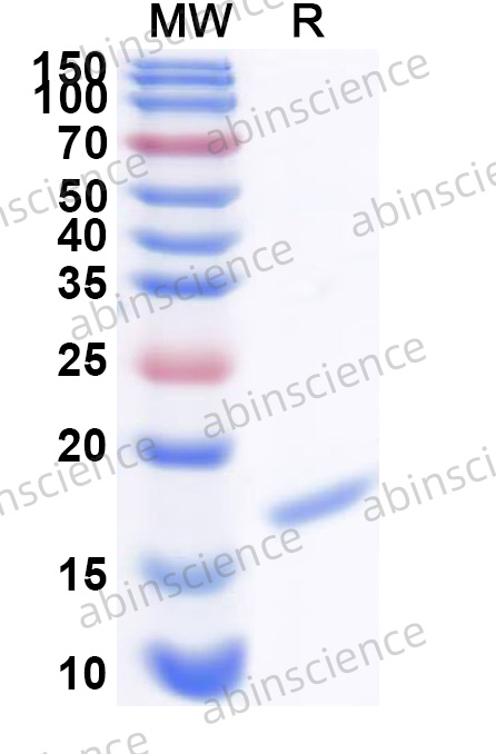 Human ERVH48-1 Recombinant Protein (N-His)