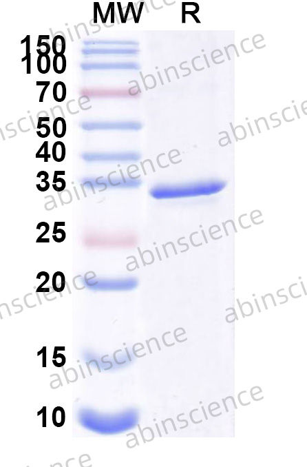 Human NRG3 Recombinant Protein (N-GST & C-His)