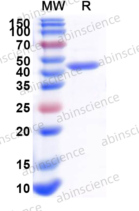 Human ETNK1 Recombinant Protein (N-His)