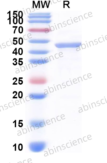 Human ACOT9 Recombinant Protein (N-His)