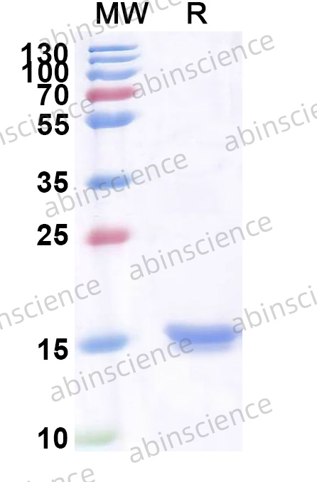 Human Periaxin Recombinant Protein (N-His)