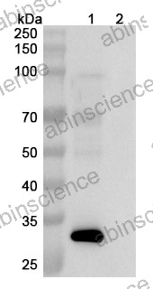 Anti-Human TGF-alpha&Epiregulin Reference Antibody (Fepixnebart, RUO)