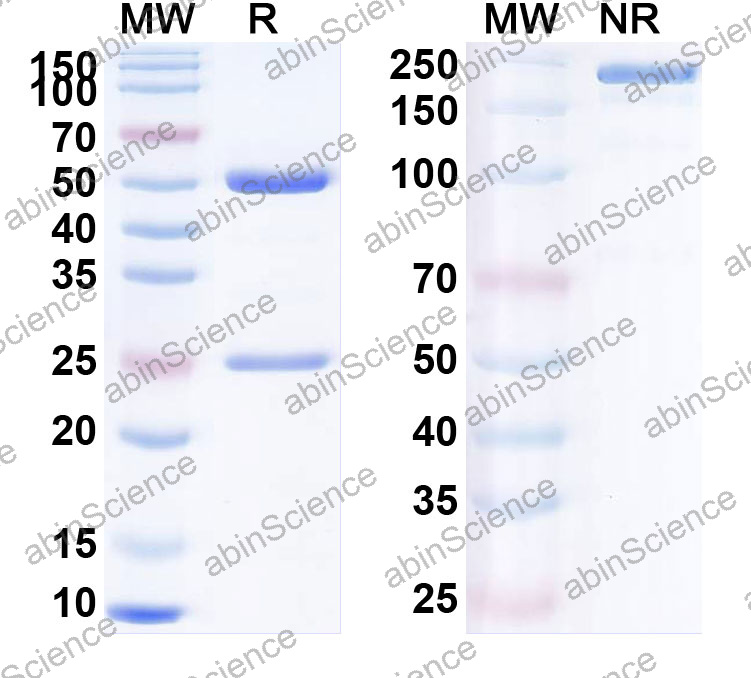 Anti-Human Hom s 5/KRT6A Monoclonal Antibody (1A583)