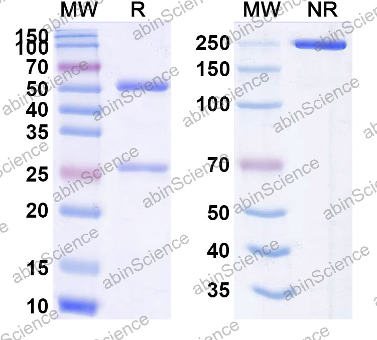 Anti-Human SERPINA3 Monoclonal Antibody (1A703)