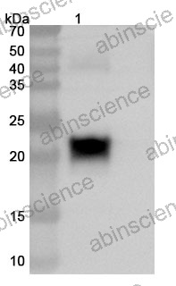 InVivoMAb Anti-Human PRL-3/PTP4A3 Antibody (Iv0170)