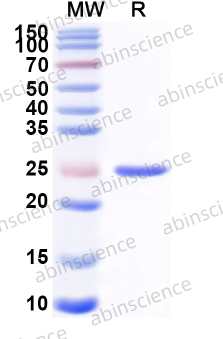 Human MACROH2A1 Recombinant Protein (N-His)