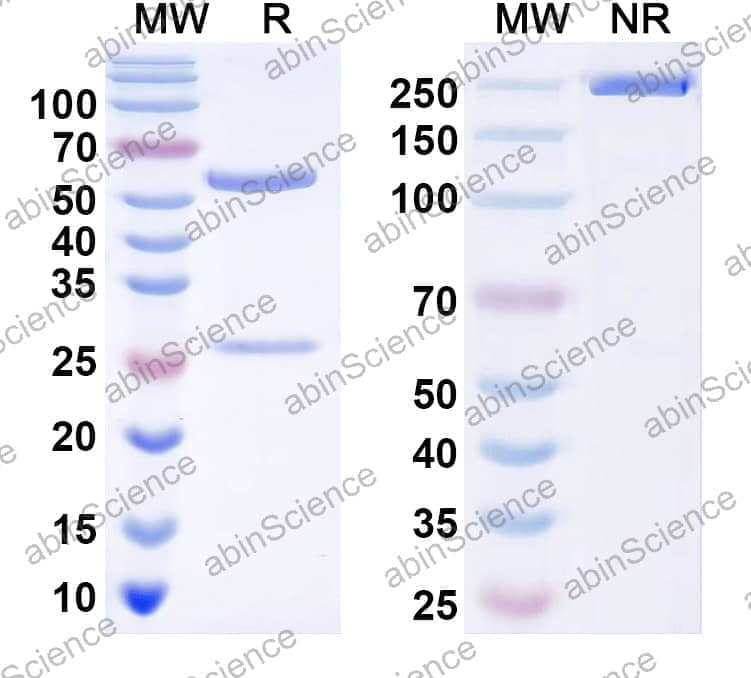 Anti-Human Alpha-1-antitrypsin/AAT Z polymer specific Recombinant Antibody (2C1)