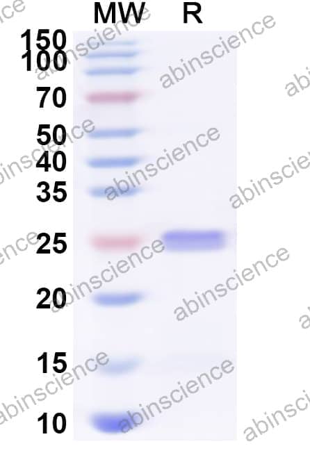 Human CRTAM Recombinant Protein (N-His)