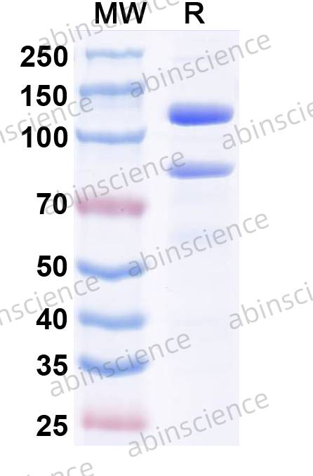 Human Complement C5 Recombinant Protein (C-His)