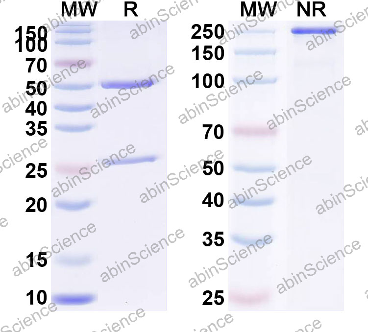 Anti-Human SH2D1A Monoclonal Antibody (1A652)