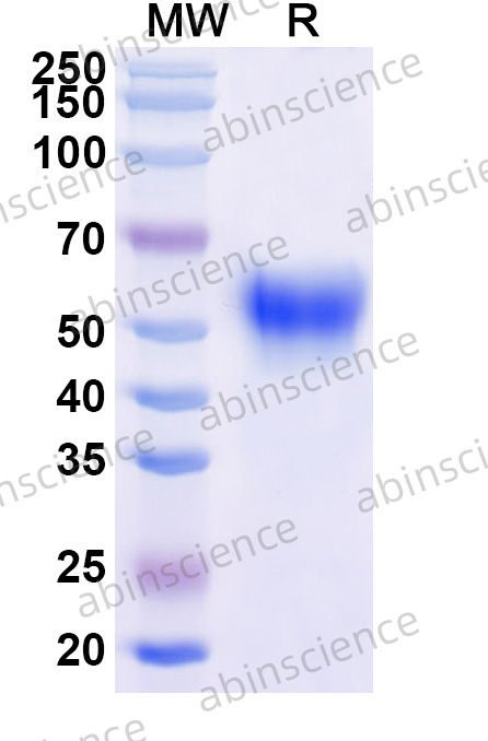 Human FSH Dimer Recombinant Protein (C-Fc)