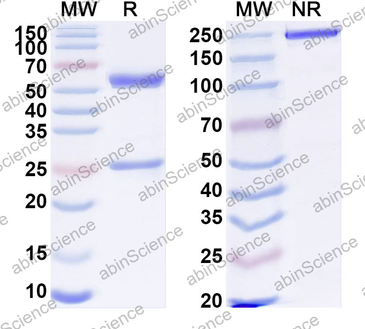 Anti-Human MB Monoclonal Antibody (1A600)
