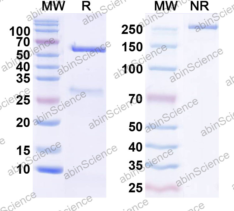 Anti-Human MB Monoclonal Antibody (1A601)