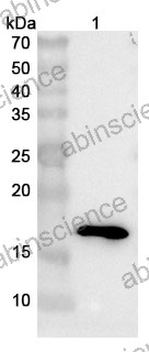 Anti-Human IFNG/IFN-gamma Recombinant Nanobody (SAA2798)