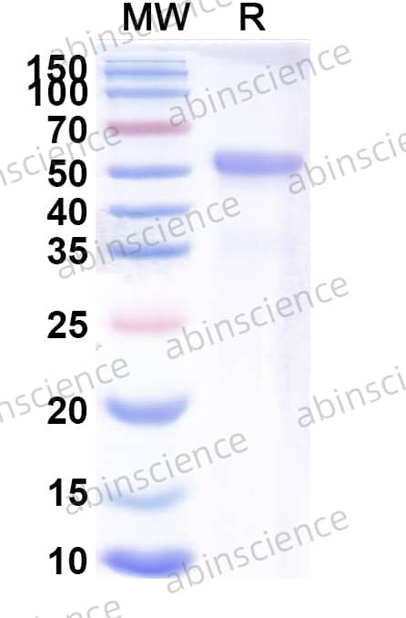 Human CD8 alpha Recombinant Protein (C-Fc)