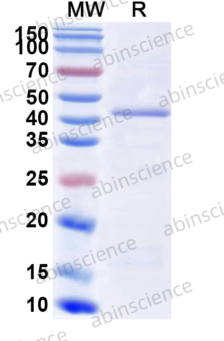 Human FLNB Recombinant Protein (N-His)