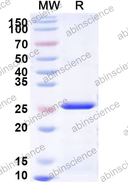 Human NKp46/NCR1 Recombinant Protein (N-His)