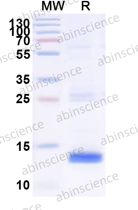 Human RAMP1 Recombinant Protein (N-His)