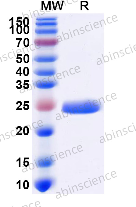 Human C-Reactive Protein