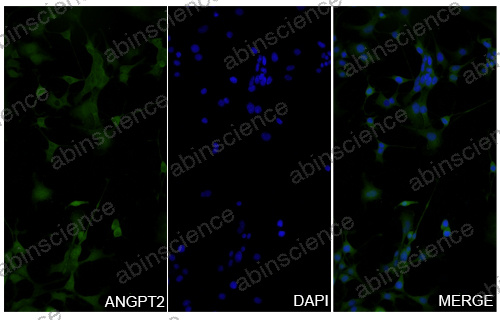 Anti-Human SOD1 Recombinant Nanobody (SAA1203)