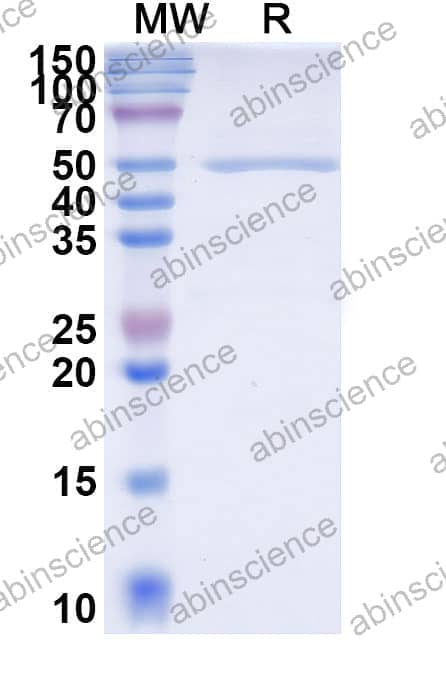 Human ADAMTS4 Recombinant Protein (C-10His)