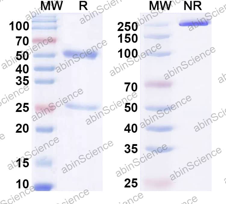 Anti-Human F9/Factor IX Recombinant Antibody (SAA2440)