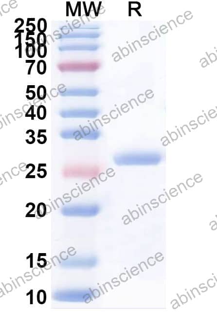 Human CLDN1 Recombinant Protein (N-His-KSI)