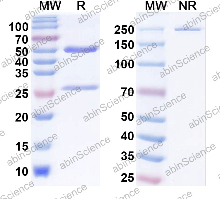 Anti-Human CD25/IL2RA Monoclonal Antibody (1A685)
