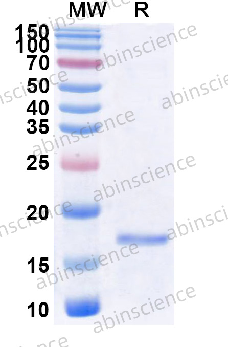 Anti-Human CD8 Recombinant Nanobody (SAA2076)