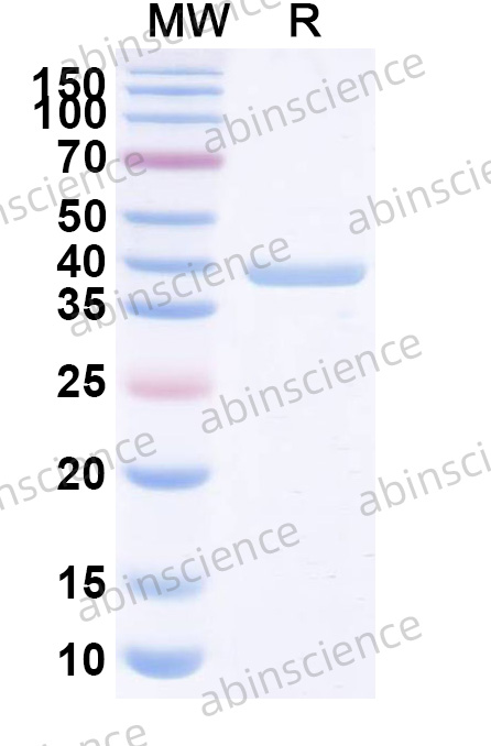 Human FOCAD Recombinant Protein (N-GST & C-His)