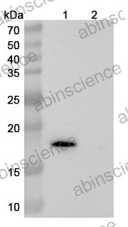 Anti-Human Transthyretin/Prealbumin Reference Antibody (Coramitug, RUO)